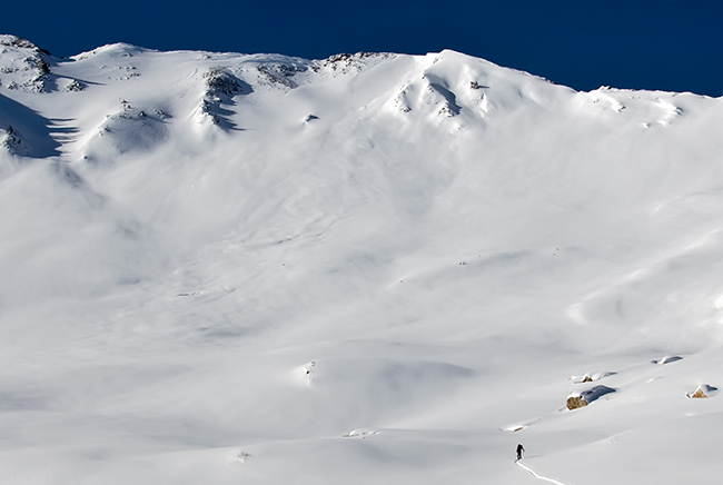 cardiac ridge slide